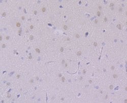 Invitrogen USP7 Recombinant Rabbit Monoclonal Antibody (JB80-36) 100 &mu;L;