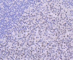 Invitrogen USP7 Recombinant Rabbit Monoclonal Antibody (JB80-36) 100 &mu;L;