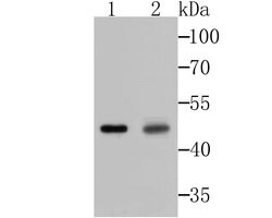 Invitrogen Galectin 8 Recombinant Rabbit Monoclonal Antibody (JB85-35) 100 &mu;L | Buy Online | Invitrogen&trade; | Fisher Scientific