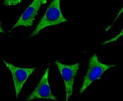 Invitrogen CYP17A1 Recombinant Rabbit Monoclonal Antibody (JB93-32) 100