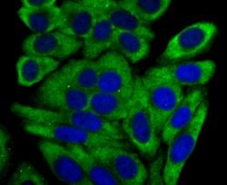 Invitrogen CYP17A1 Recombinant Rabbit Monoclonal Antibody (JB93-32) 100