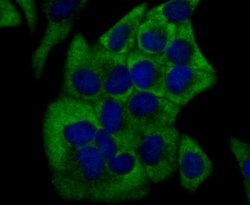 Invitrogen CYP17A1 Recombinant Rabbit Monoclonal Antibody (JB93-32) 100