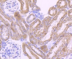 Invitrogen CYP17A1 Recombinant Rabbit Monoclonal Antibody (JB93-32) 100