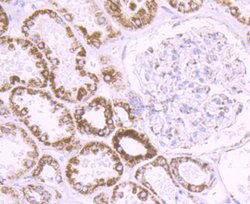 Invitrogen CYP17A1 Recombinant Rabbit Monoclonal Antibody (JB93-32) 100