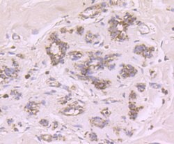 Invitrogen CYP17A1 Recombinant Rabbit Monoclonal Antibody (JB93-32) 100