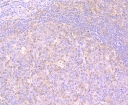 Invitrogen GSS Recombinant Rabbit Monoclonal Antibody (JB95-33) 100 &mu;L;