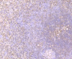 Invitrogen STIP1 Recombinant Rabbit Monoclonal Antibody (JB95-38) 100 &mu;L | Buy Online | Invitrogen&trade; | Fisher Scientific