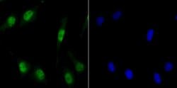 Invitrogen MCM3 Recombinant Rabbit Monoclonal Antibody (JB99-35) 100 &mu;L;