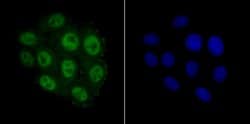 Invitrogen MCM3 Recombinant Rabbit Monoclonal Antibody (JB99-35) 100 &mu;L;