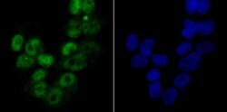 Invitrogen MCM3 Recombinant Rabbit Monoclonal Antibody (JB99-35) 100 &mu;L;