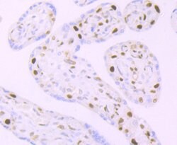 Invitrogen MCM3 Recombinant Rabbit Monoclonal Antibody (JB99-35) 100 &mu;L;