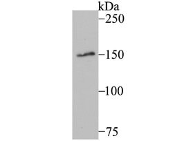 Invitrogen MYBBP1A Recombinant Rabbit Monoclonal Antibody (JB40-09) 100