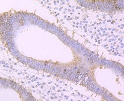 Invitrogen FZD8 Recombinant Rabbit Monoclonal Antibody (JB40-16) 100 &mu;L | Buy Online | Invitrogen&trade; | Fisher Scientific