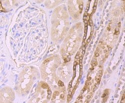Invitrogen FZD8 Recombinant Rabbit Monoclonal Antibody (JB40-16) 100 &mu;L | Buy Online | Invitrogen&trade; | Fisher Scientific