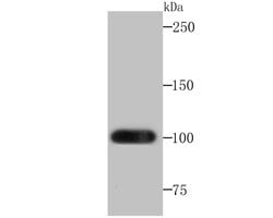 Invitrogen FZD8 Recombinant Rabbit Monoclonal Antibody (JB40-16) 100 &mu;L | Buy Online | Invitrogen&trade; | Fisher Scientific