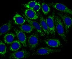 Invitrogen CPS1 Recombinant Rabbit Monoclonal Antibody (JB40-33) 100 μL;