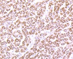 Invitrogen CPS1 Recombinant Rabbit Monoclonal Antibody (JB40-33) 100 μL;