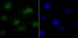 Invitrogen SRSF1 Recombinant Rabbit Monoclonal Antibody (JB40-76) 100 &mu;L;