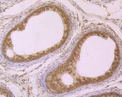 Invitrogen SRSF1 Recombinant Rabbit Monoclonal Antibody (JB40-76) 100 &mu;L;