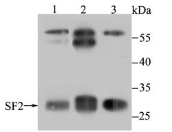 Invitrogen SRSF1 Recombinant Rabbit Monoclonal Antibody (JB40-76) 100 &mu;L;