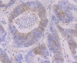 Invitrogen RRM1 Recombinant Rabbit Monoclonal Antibody (JB09-43) 100 μL;