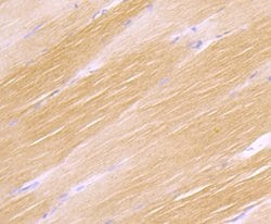 Invitrogen H-cadherin Recombinant Rabbit Monoclonal Antibody (JB14-48)