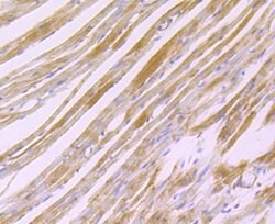 Invitrogen H-cadherin Recombinant Rabbit Monoclonal Antibody (JB14-48)