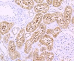 Invitrogen H-cadherin Recombinant Rabbit Monoclonal Antibody (JB14-48)