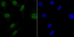 Invitrogen MBD3 Recombinant Rabbit Monoclonal Antibody (JB61-47) 100 &mu;L;