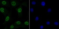 Invitrogen MBD3 Recombinant Rabbit Monoclonal Antibody (JB61-47) 100 &mu;L;