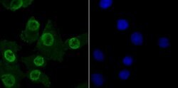 Invitrogen MBD3 Recombinant Rabbit Monoclonal Antibody (JB61-47) 100 &mu;L;