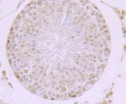Invitrogen MBD3 Recombinant Rabbit Monoclonal Antibody (JB61-47) 100 &mu;L;