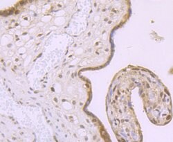 Invitrogen MBD3 Recombinant Rabbit Monoclonal Antibody (JB61-47) 100 &mu;L;