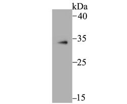 Invitrogen MBD3 Recombinant Rabbit Monoclonal Antibody (JB61-47) 100 &mu;L;