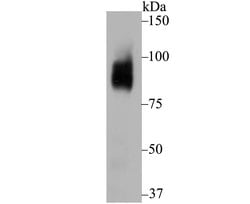 Invitrogen BCL6 Recombinant Rabbit Monoclonal Antibody (JB18-48) 100 &mu;L;
