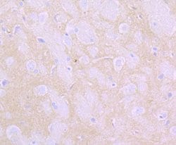 Invitrogen Flotillin 1 Recombinant Rabbit Monoclonal Antibody (JB19-45) 100 &mu;L | Buy Online | Invitrogen&trade; | Fisher Scientific