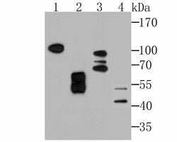 Invitrogen KDEL Recombinant Rabbit Monoclonal Antibody (JB42-04) 100 &mu;L | Buy Online | Invitrogen&trade; | Fisher Scientific