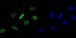Invitrogen H4K16ac Recombinant Rabbit Monoclonal Antibody (JB21-44) 100