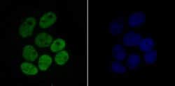 Invitrogen H4K16ac Recombinant Rabbit Monoclonal Antibody (JB21-44) 100