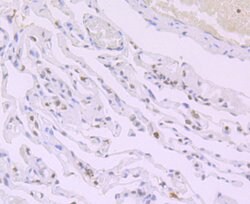 Invitrogen H4K16ac Recombinant Rabbit Monoclonal Antibody (JB21-44) 100