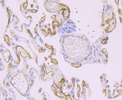 Invitrogen Thrombomodulin Recombinant Rabbit Monoclonal Antibody (JB48-23)