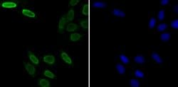 Invitrogen SNRPA Recombinant Rabbit Monoclonal Antibody (JB33-48) 100 &mu;L | Buy Online | Invitrogen&trade; | Fisher Scientific