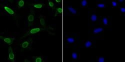 Invitrogen SNRPA Recombinant Rabbit Monoclonal Antibody (JB33-48) 100 &mu;L | Buy Online | Invitrogen&trade; | Fisher Scientific