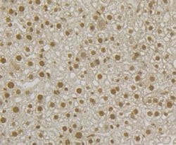 Invitrogen SNRPA Recombinant Rabbit Monoclonal Antibody (JB33-48) 100 &mu;L | Buy Online | Invitrogen&trade; | Fisher Scientific