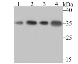 Invitrogen SNRPA Recombinant Rabbit Monoclonal Antibody (JB33-48) 100 &mu;L | Buy Online | Invitrogen&trade; | Fisher Scientific