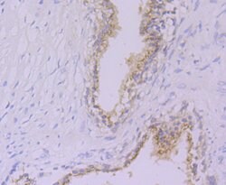 Invitrogen GPI Recombinant Rabbit Monoclonal Antibody (JG33-86) 100 &mu;L;