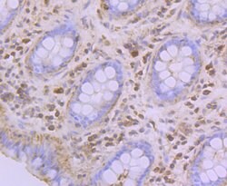 Invitrogen GPI Recombinant Rabbit Monoclonal Antibody (JG33-86) 100 &mu;L;