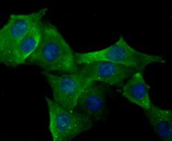 Invitrogen ERP29 Recombinant Rabbit Monoclonal Antibody (JG34-42) 100 &mu;L;