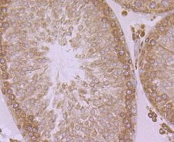 Invitrogen ERP29 Recombinant Rabbit Monoclonal Antibody (JG34-42) 100 &mu;L;