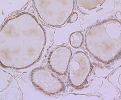 Invitrogen ERP29 Recombinant Rabbit Monoclonal Antibody (JG34-42) 100 &mu;L;